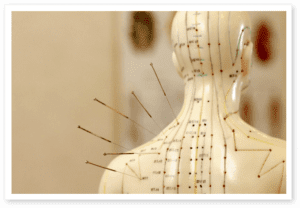 Acupuncture Diagram